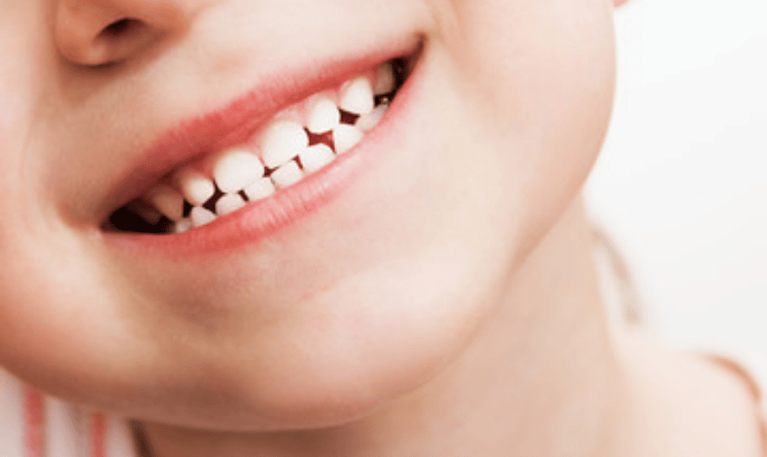 Fluoride benefits for children's oral health