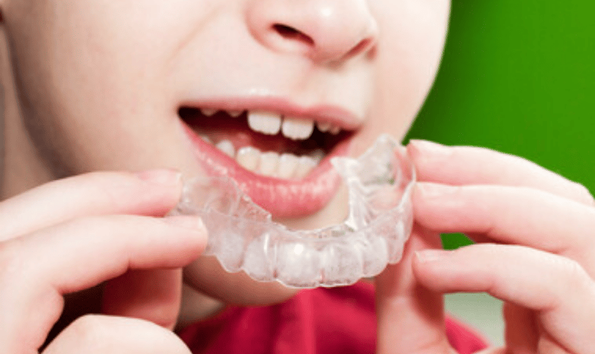 Orthodontic treatment kids