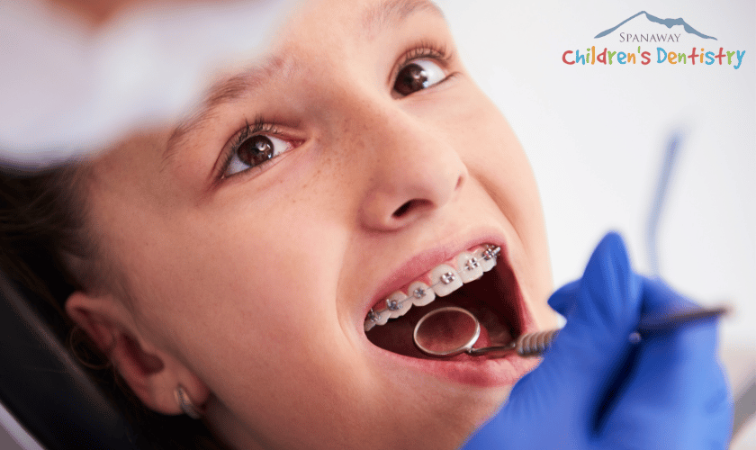 When Should Kids Get Early Orthodontic Care?