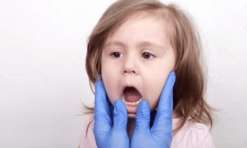 Bleeding Gums in Children: What Should You Do?